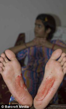 ӡ����Ů��ֲ� ���岻��������Ѫ(��ͼ)