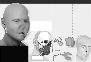 ������ֲ��������ʾ��ͼ